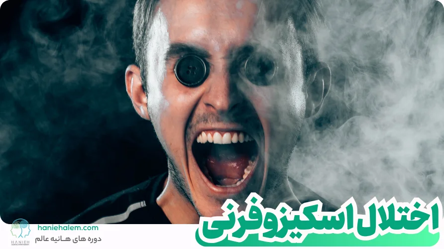 اختلال اسکیزوفرنی